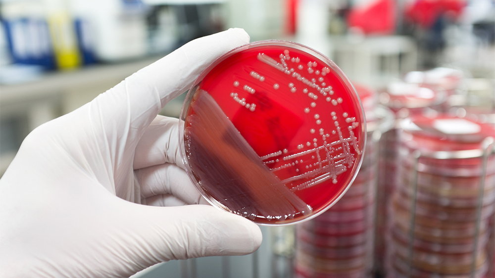 In the laboratory, bacteria are often cultivated in Petri dishes on a nutrient medium that supplies the growing microorganisms with water and nutrients. (Image: iStock.com/zmeel)