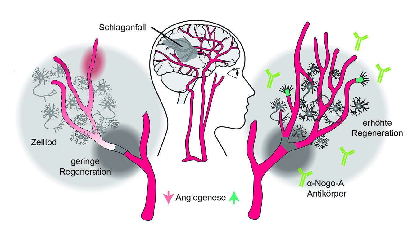 Schematische Darstellung einer potenziellen Nogo-A-Antikörper-Therapie.