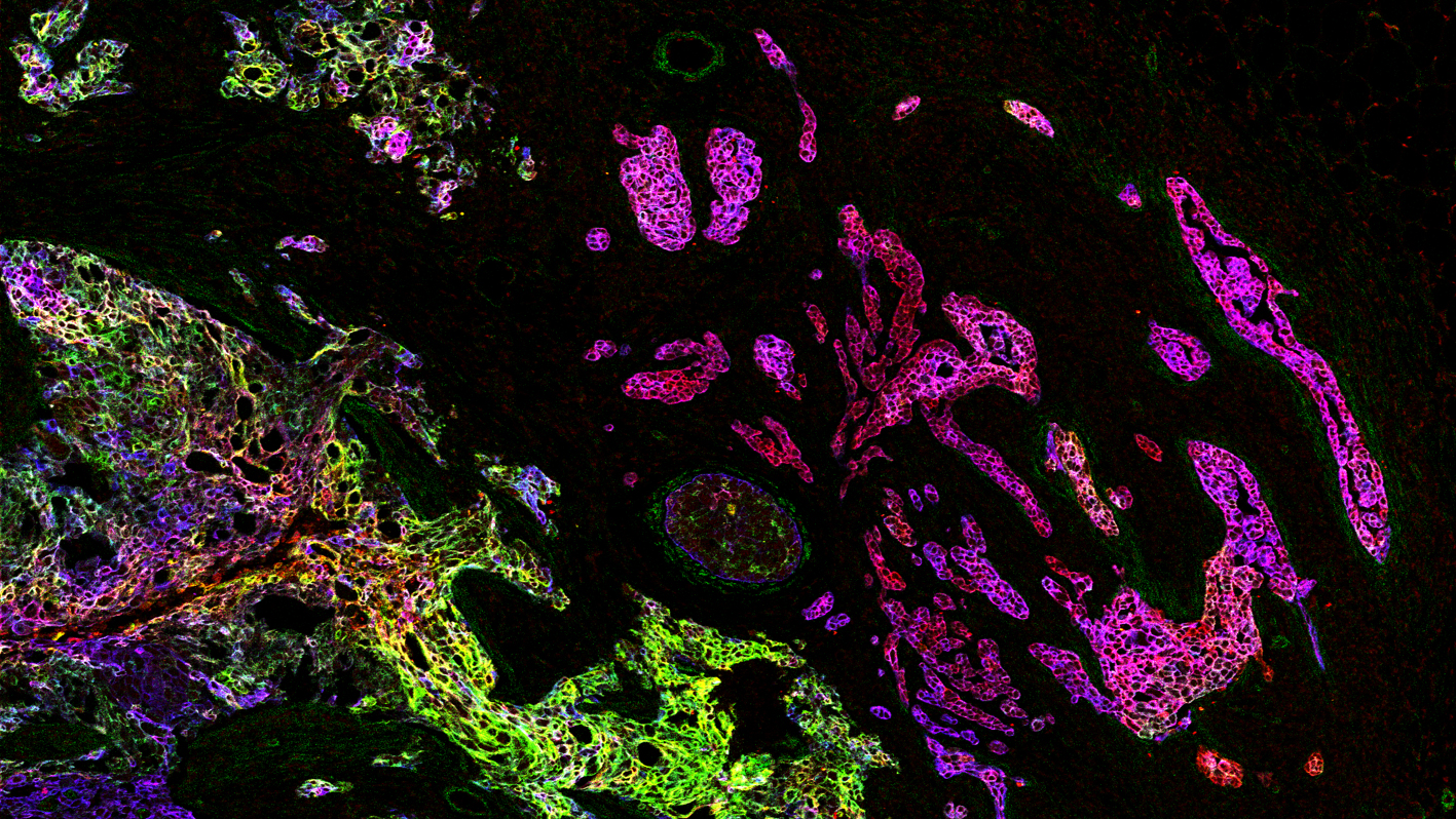Dank der Massenzytometrie können überlagerte Informationen der Gewebeschnitte gleichzeitig visualisiert und analysiert werden. 