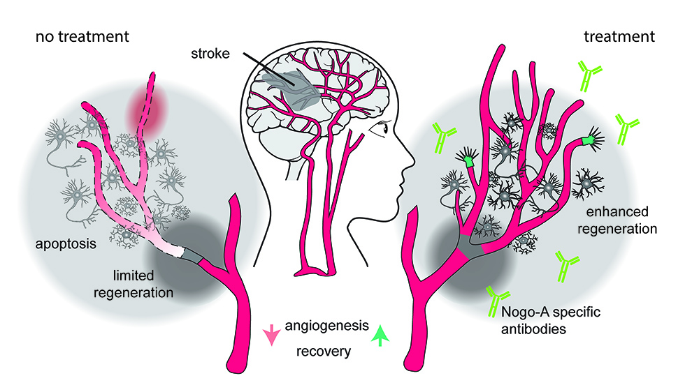 Schematische Darstellung einer potenziellen Nogo-A-Antikörper-Therapie.