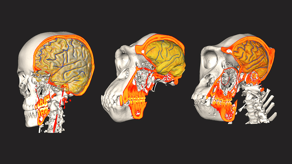 Hirn-Schädel-Entwicklung vom Affen zum Menschen